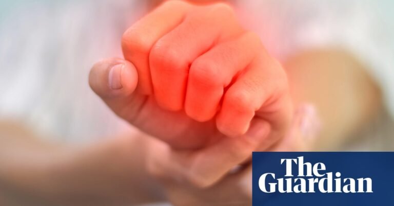 Autoimmune disease may almost double risk of mental ill health, study suggests | Mental health