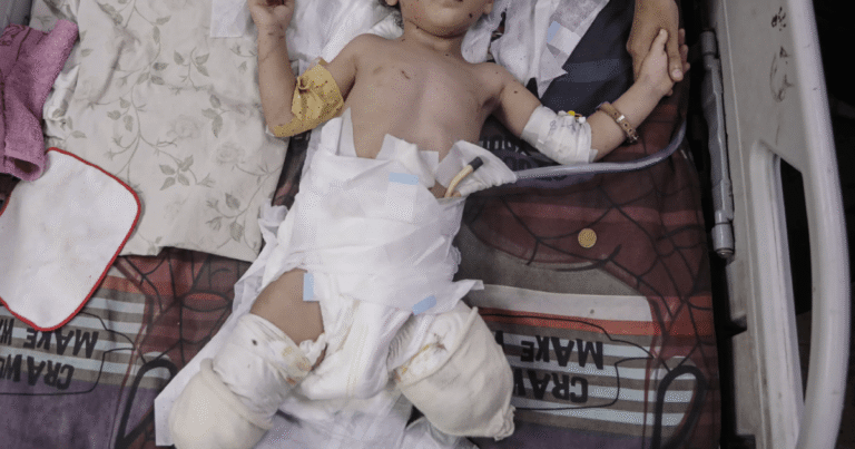 Gaza’s vulnerable suffer war’s toll: Malnourished, maimed and displaced | Interactive News